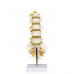 Lumbar Spinal Column with Sacral